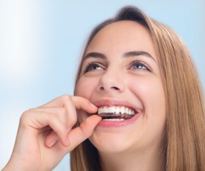 Woman putting in an Invisalign retainer